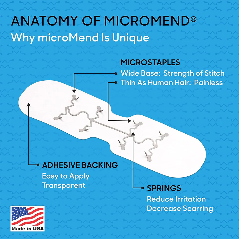 MicroMend Emergency Skin Closure - Image 3