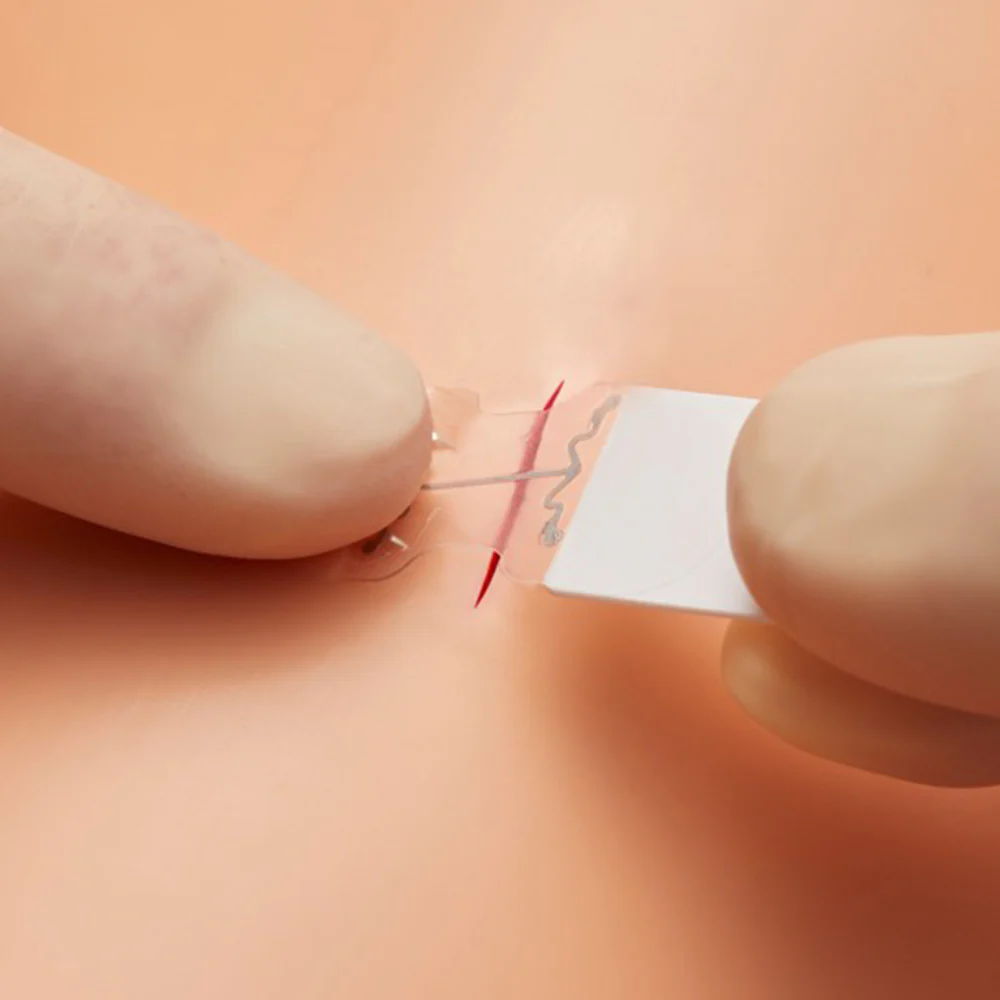 MicroMend Emergency Skin Closure - Image 4