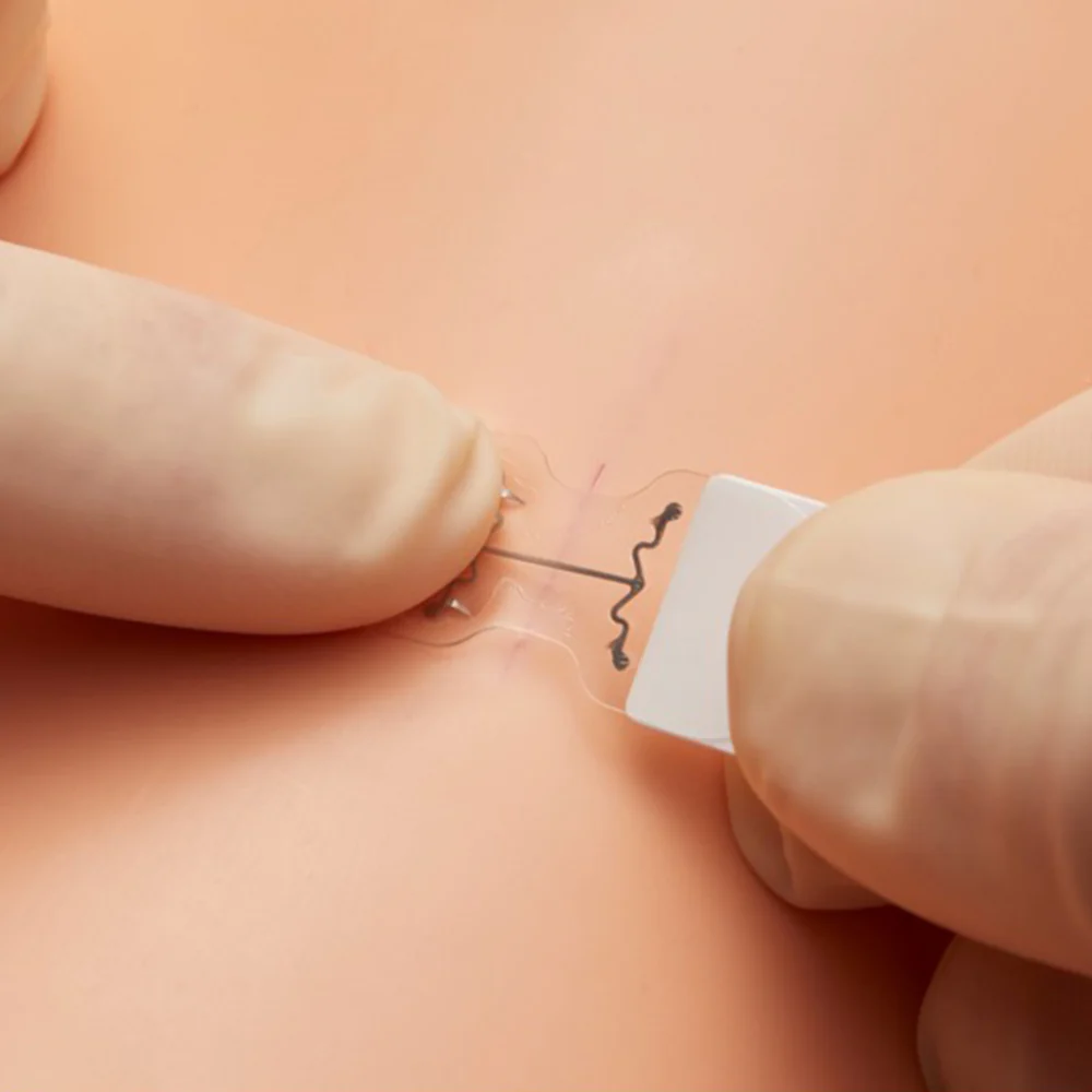 MicroMend Emergency Skin Closure - Image 5
